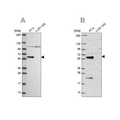 Western Blot: IRF6 Antibody [NBP2-55961]