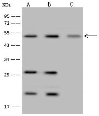 Western Blot: IRF6 Antibody [NBP2-99348]