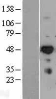 Western Blot: IRF6 Overexpression Lysate [NBL1-12036]