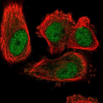 Immunocytochemistry/ Immunofluorescence: IRF7 Antibody [NBP2-38678]