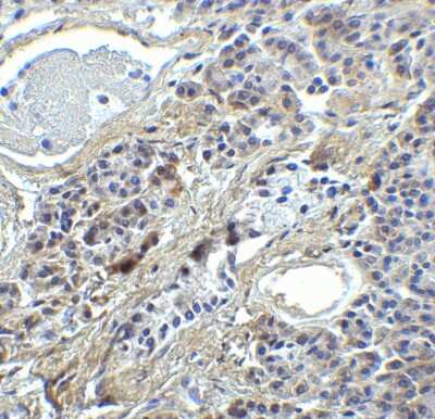 Immunohistochemistry: IRF7 Antibody - BSA Free [NBP3-06987]