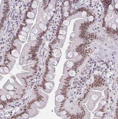 Immunohistochemistry-Paraffin: IRF7 Antibody [NBP2-38678]