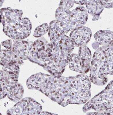 Immunohistochemistry-Paraffin: IRF7 Antibody [NBP2-38678]