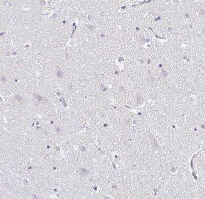 Immunohistochemistry-Paraffin: IRF7 Antibody [NBP2-38678]