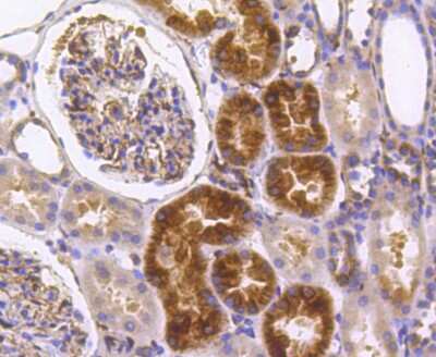 Immunohistochemistry-Paraffin: IRF7 Antibody (SC0617) [NBP2-67634]