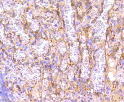 Immunohistochemistry-Paraffin: IRF7 Antibody (SC0617) [NBP2-67634]