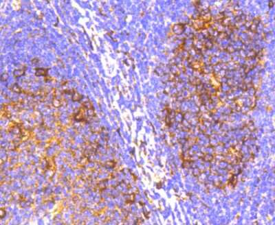 Immunohistochemistry-Paraffin: IRF7 Antibody (SC0617) [NBP2-67634]