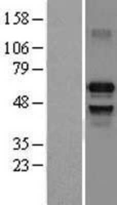 Western Blot: IRF7 Overexpression Lysate [NBL1-12037]