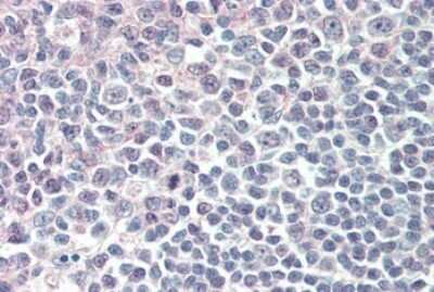 Immunohistochemistry-Paraffin: IRF8 Antibody [NB100-1093]