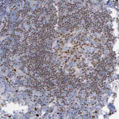 Immunohistochemistry-Paraffin: IRF8 Antibody [NBP1-81614]