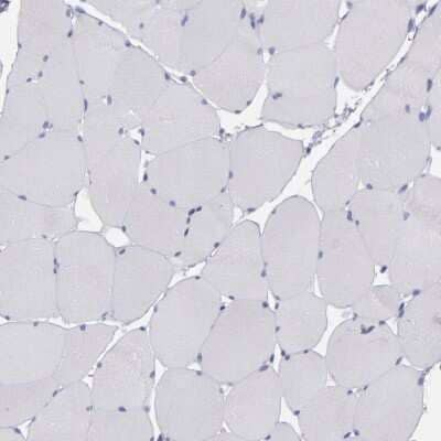 Immunohistochemistry-Paraffin: IRF8 Antibody [NBP1-81614]