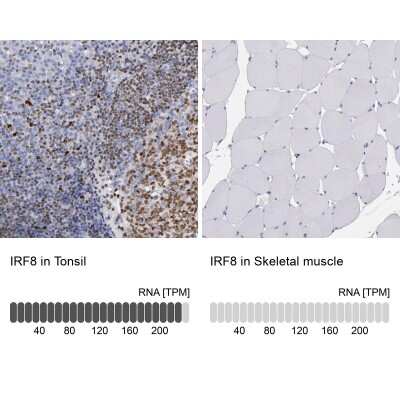 Immunohistochemistry-Paraffin: IRF8 Antibody [NBP1-81614]