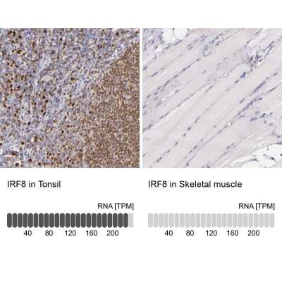 Immunohistochemistry-Paraffin: IRF8 Antibody [NBP1-83123]