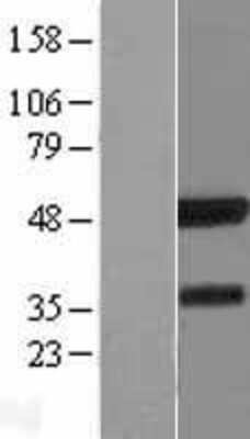 Western Blot: IRF8 Overexpression Lysate [NBP2-08141]