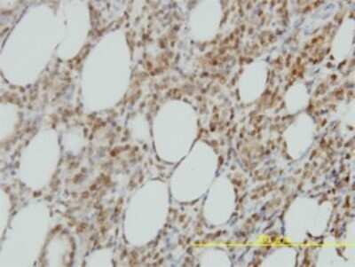 Immunohistochemistry-Paraffin: IRF9 Antibody (1D11) [H00010379-M02]