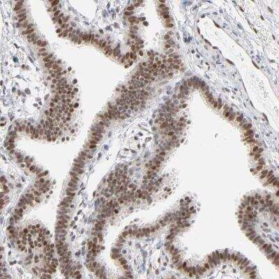 Immunohistochemistry-Paraffin: IRF9 Antibody [NBP1-81577]
