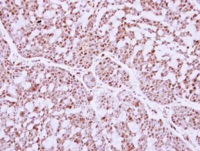 Immunohistochemistry-Paraffin: IRF9 Antibody [NBP2-16991]