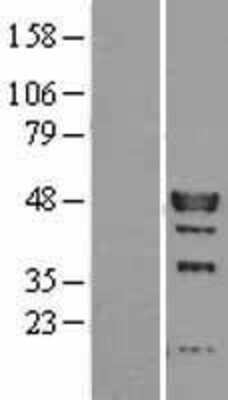 Western Blot: IRF9 Overexpression Lysate [NBL1-12038]