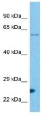 Western Blot: IRG1 Antibody [NBP3-10125]