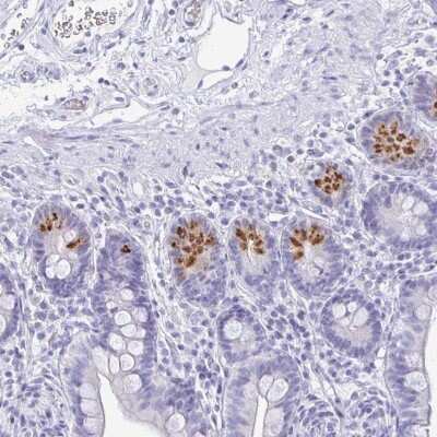 Immunohistochemistry: IRGC Antibody [NBP2-32512]