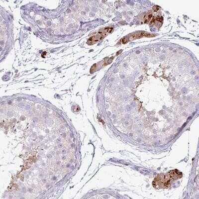 Immunohistochemistry-Paraffin: IRGC Antibody [NBP2-14129]