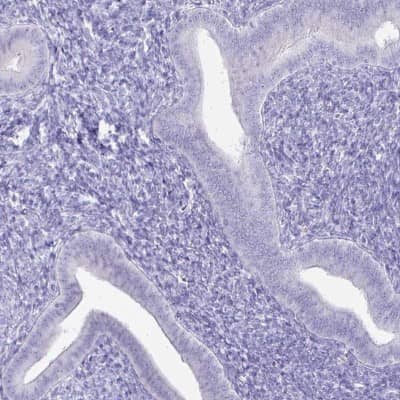 Immunohistochemistry-Paraffin: IRGC Antibody [NBP2-32512]