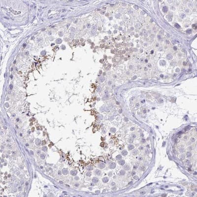 Immunohistochemistry-Paraffin: IRGC Antibody [NBP2-32512]