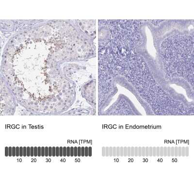 Immunohistochemistry-Paraffin: IRGC Antibody [NBP2-32512]
