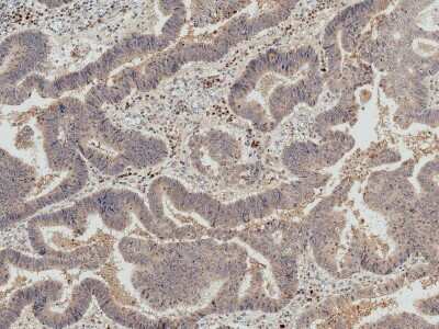 Immunohistochemistry: IRGM Antibody [NBP3-18254]