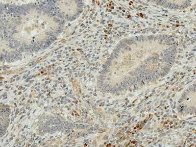 Immunohistochemistry: IRGM Antibody [NBP3-18254]