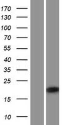 Western Blot: IRGM Overexpression Lysate [NBP2-09763]