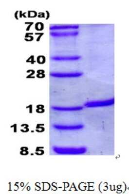 SDS-PAGE: Recombinant Human IRGM His Protein [NBP2-23131]