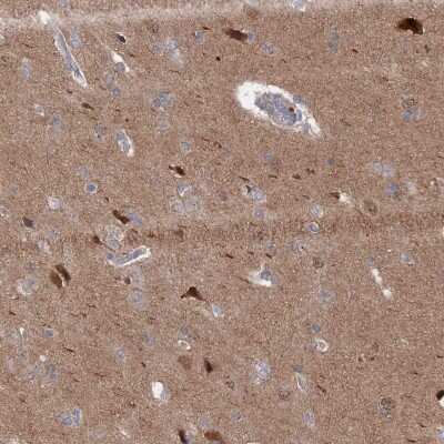 Immunohistochemistry-Paraffin: IRGQ Antibody [NBP1-94049]
