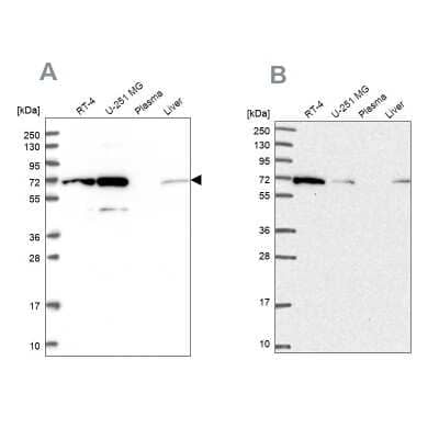Western Blot: IRGQ Antibody [NBP1-94049]