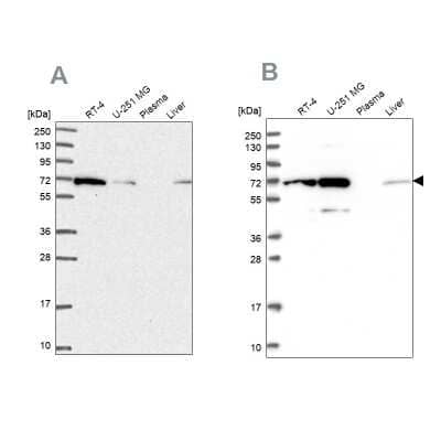 Western Blot: IRGQ Antibody [NBP2-58334]