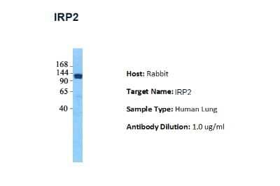 Western Blot: IRP2 Antibody [NBP3-10538]