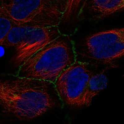 Immunocytochemistry/ Immunofluorescence: IRP2 Antibody [NBP2-55039]