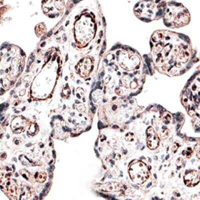 Immunohistochemistry-Paraffin: IRP2 Antibody [NB100-1798]