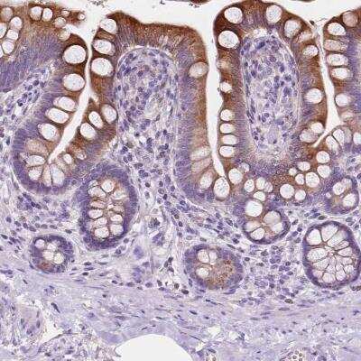 Immunohistochemistry-Paraffin: IRP2 Antibody [NBP2-49576]