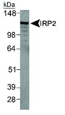 Western Blot: IRP2 Antibody [NB100-1798]