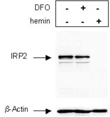 Western Blot: IRP2 Antibody [NB100-1798]