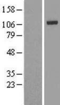 Western Blot: IRP2 Overexpression Lysate [NBL1-12029]