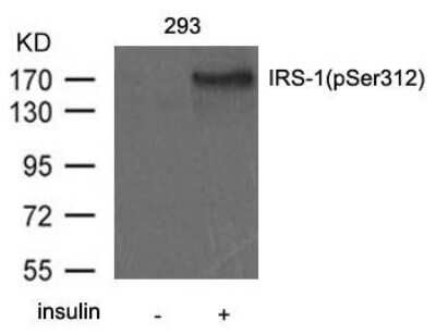 Western Blot: IRS1 [p Ser312] Antibody [NB100-81999]