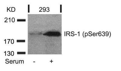 Western Blot: IRS1 [p Ser639] Antibody [NB100-82000]