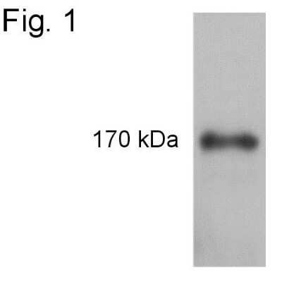 Western Blot: IRS1 [p Tyr1179] Antibody [NB100-74450]