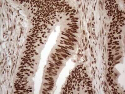 Immunohistochemistry: IRS1 Antibody (OTI3G10) [NBP2-45435]