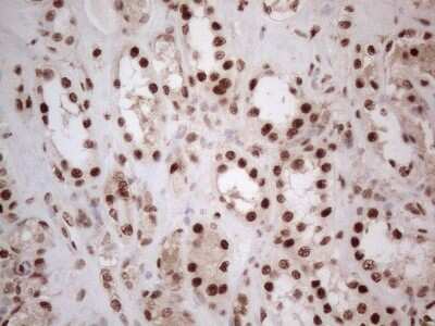 Immunohistochemistry: IRS1 Antibody (OTI3G10) [NBP2-45435]
