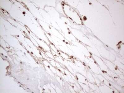 Immunohistochemistry: IRS1 Antibody (OTI3G10) [NBP2-45435]
