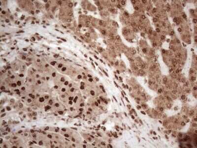 Immunohistochemistry: IRS1 Antibody (OTI3G10) [NBP2-45435]