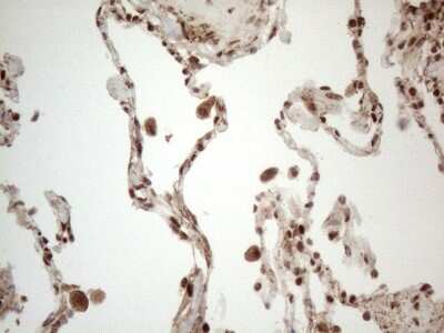 Immunohistochemistry: IRS1 Antibody (OTI3G10) [NBP2-45435]